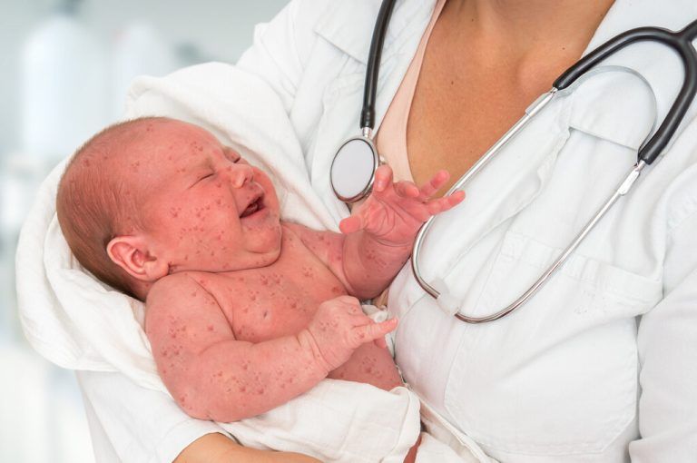Das hoch ansteckende Virus ist in Österreich auf dem Vormarsch.Shutterstock