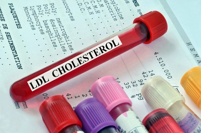 Nicht nur „gutes“ und „schlechtes“ Cholesterin relevant.⇒Shutterstock