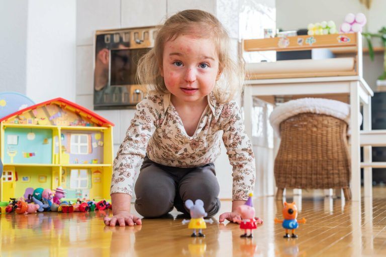 Lilijana, ein Schmetterlingskind, gehört jetzt zu den NEUE-Patenkindern.⇒stiplovsek